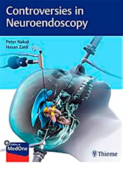 Imagem de Controversies in Neuroendoscopy