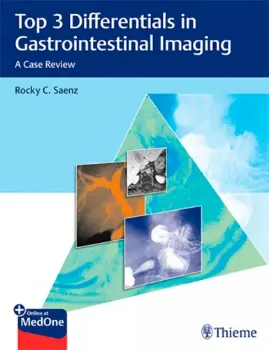 Imagem de Top 3 Differentials in Gastrointestinal Imaging: A Case Review