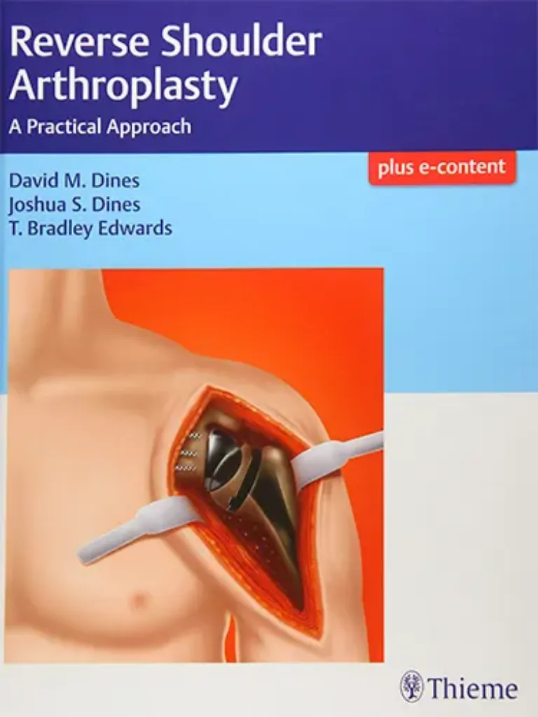 Imagem de Reverse Shoulder Arthroplasty: A Practical Approach
