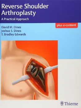 Picture of Book Reverse Shoulder Arthroplasty: A Practical Approach