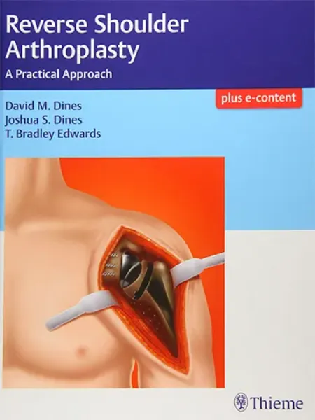 Imagem de Reverse Shoulder Arthroplasty: A Practical Approach