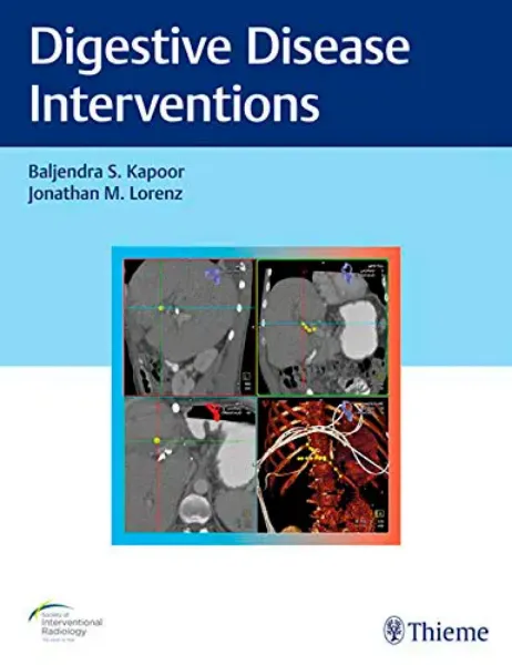 Imagem de Digestive Disease Interventions
