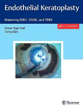 Imagem de Endothelial Keratoplasty: Mastering DSEK, DMEK, and PDEK