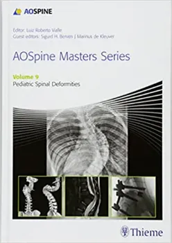 Imagem de AO Spine Masters Series: Pediatric Spinal Deformities Vol. 9