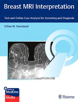 Picture of Book Breast MRI Interpretation: Text and Online Case Analysis for Screening and Diagnosis