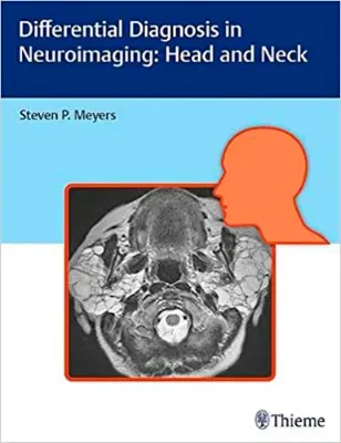 Imagem de Differential Diagnosis in Neuroimaging: Head and Neck