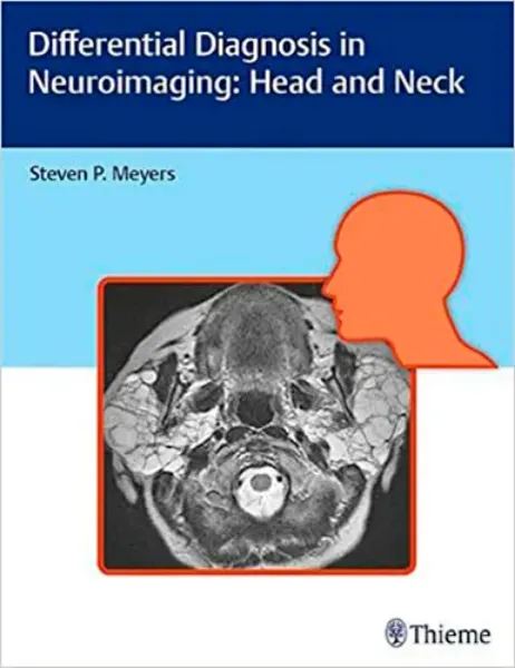 Imagem de Differential Diagnosis in Neuroimaging: Head and Neck