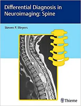 Picture of Book Differential Diagnosis in Neuroimaging: Spine