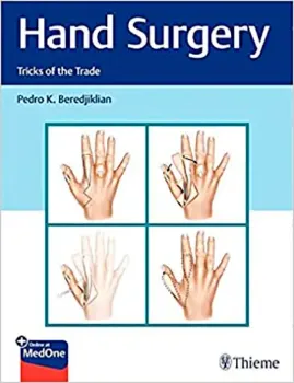 Imagem de Hand Surgery: Tricks of the Trade
