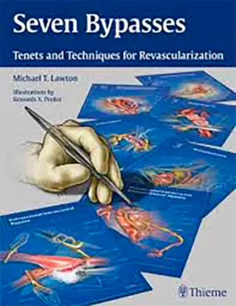 Imagem de Seven Bypasses: Tenets and Techniques for Revascularization