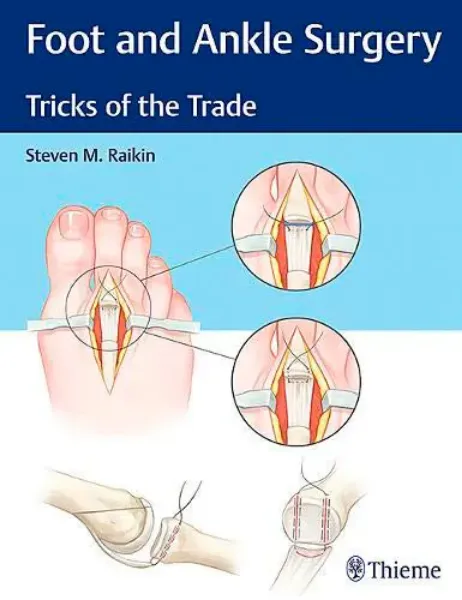 Imagem de Foot and Ankle Surgery: Tricks of the Trade