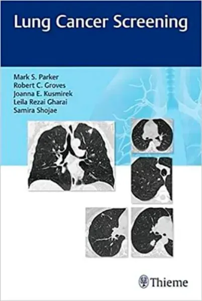 Imagem de Lung Cancer Screening