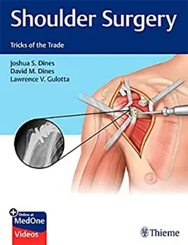 Picture of Book Shoulder Surgery: Tricks of the Trade