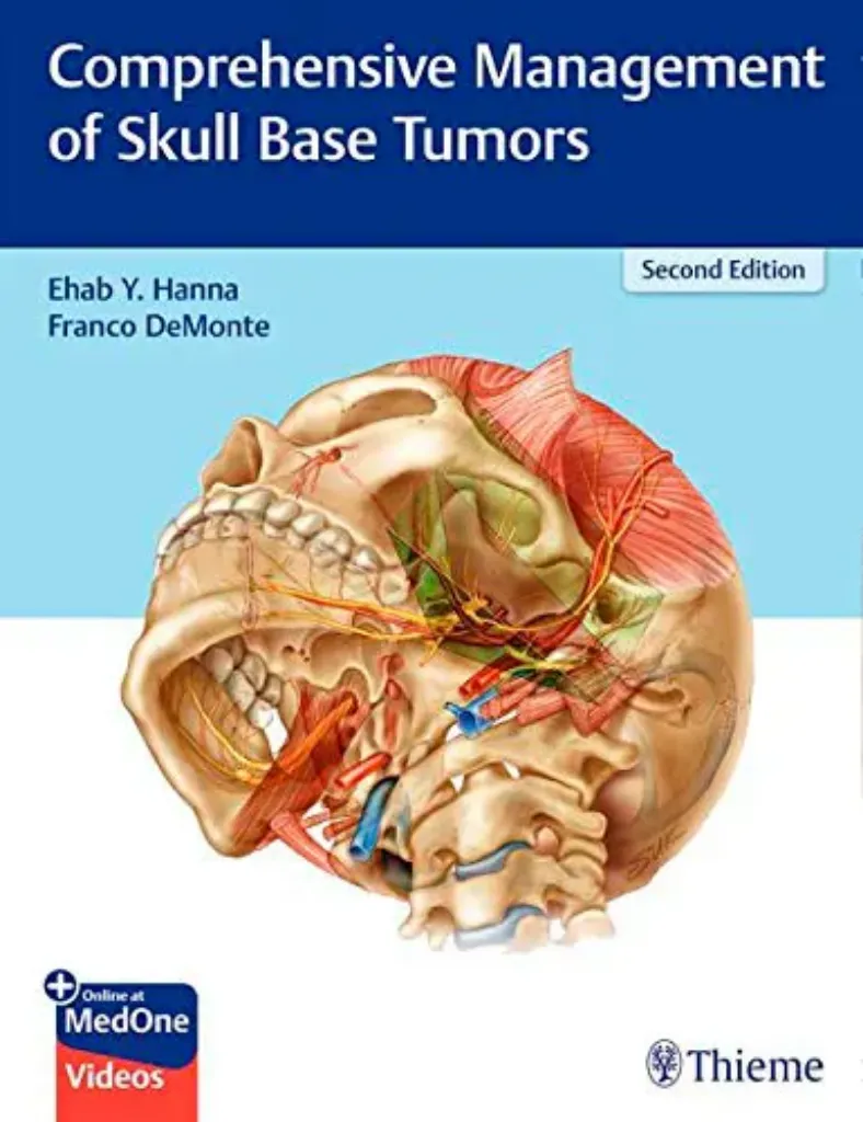 Imagem de Comprehensive Management of Skull Base Tumors