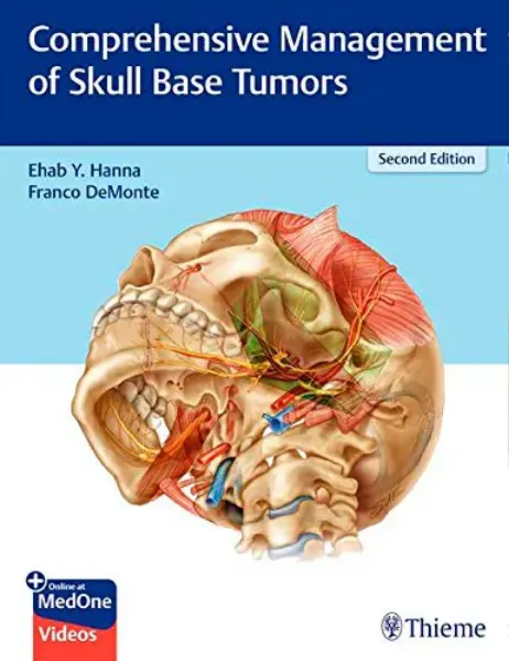 Imagem de Comprehensive Management of Skull Base Tumors