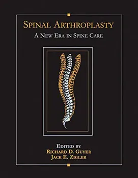 Imagem de Spinal Arthroplasty: A New Era in Spine Care