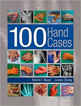 Picture of Book 100 Hand Cases