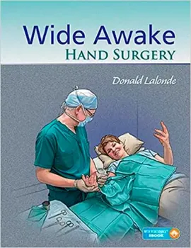 Picture of Book Wide Awake Hand Surgery 1st edition