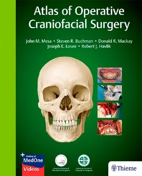 Imagem de Atlas of Operative Craniofacial Surgery