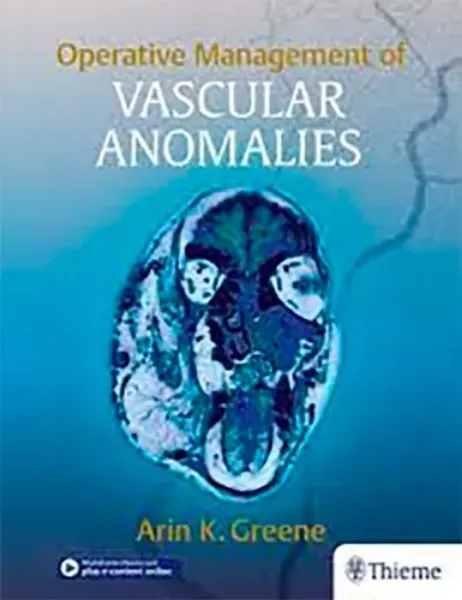 Imagem de Operative Management of Vascular Anomalies
