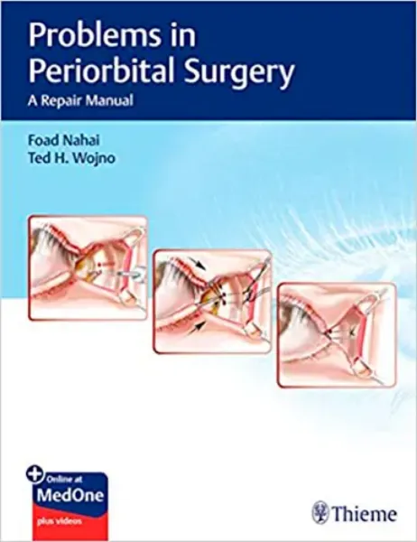Imagem de Problems in Periorbital Surgery: A Repair Manual
