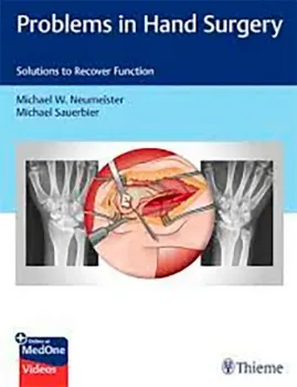 Imagem de Problems in Hand Surgery: Solutions to Recover Function