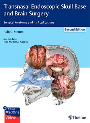 Picture of Book Transnasal Endoscopic Skull Base and Brain Surgery: Surgical Anatomy and its Applications