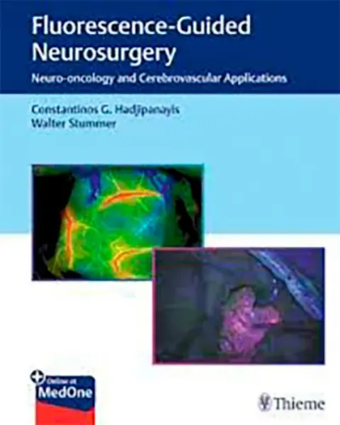 Imagem de Fluorescence-Guided Neurosurgery: Neuro-Oncology and Cerebrovascular Applications
