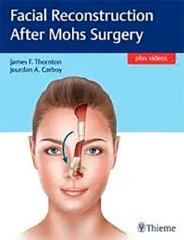 Picture of Book Facial Reconstruction After Mohs Surgery