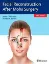 Imagem de Facial Reconstruction After Mohs Surgery
