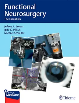 Imagem de Functional Neurosurgery: The Essentials