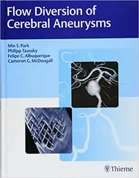 Imagem de Flow Diversion of Cerebral Aneurysms