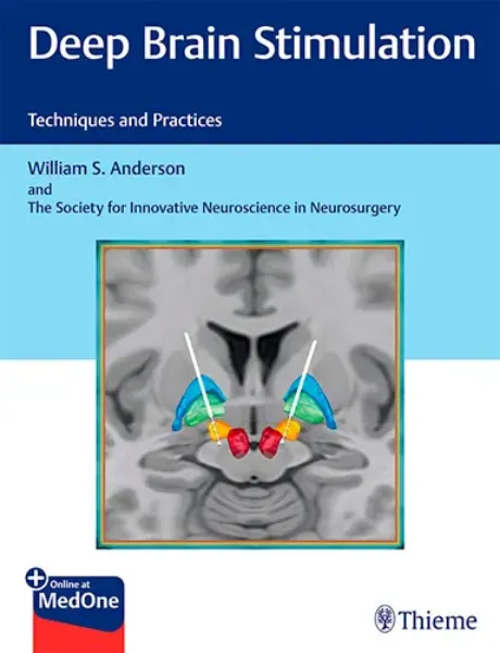 Imagem de Deep Brain Stimulation: Techniques and Practices