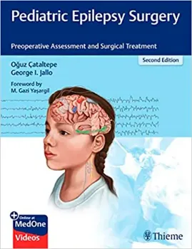 Imagem de Pediatric Epilepsy Surgery: Preoperative Assessment and Surgical Treatment