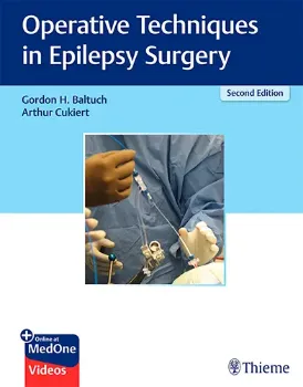 Imagem de Operative Techniques in Epilepsy Surgery