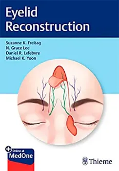 Picture of Book Eyelid Reconstruction