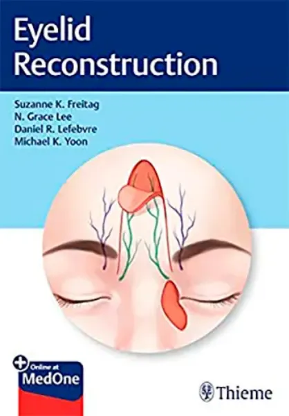 Imagem de Eyelid Reconstruction