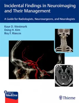 Picture of Book Incidental Findings in Neuroimaging and Their Management: A Guide for Radiologists, Neurosurgeons and Neurologists