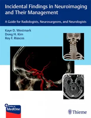 Imagem de Incidental Findings in Neuroimaging and Their Management: A Guide for Radiologists, Neurosurgeons and Neurologists