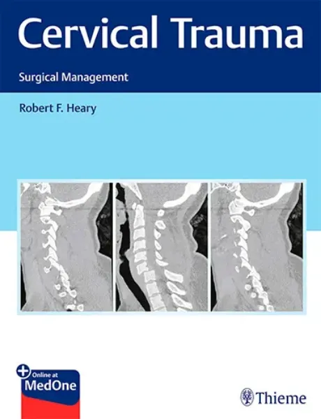 Imagem de Cervical Trauma: Surgical Management
