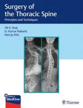 Imagem de Surgery of the Thoracic Spine: Principles and Techniques