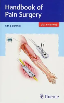 Imagem de Handbook of Pain Surgery