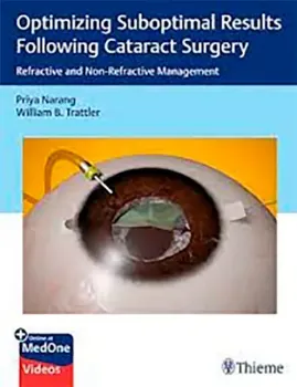 Imagem de Optimizing Suboptimal Results Following Cataract Surgery: Refractive and Non-Refractive Management