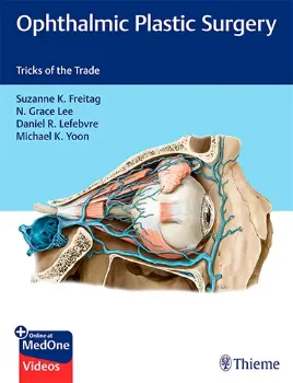 Imagem de Ophthalmic Plastic Surgery: Tricks of the Trade