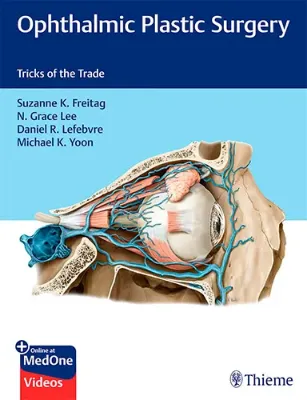 Imagem de Ophthalmic Plastic Surgery: Tricks of the Trade