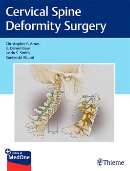 Picture of Book Cervical Spine Deformity Surgery