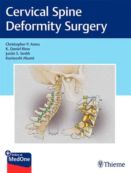 Imagem de Cervical Spine Deformity Surgery