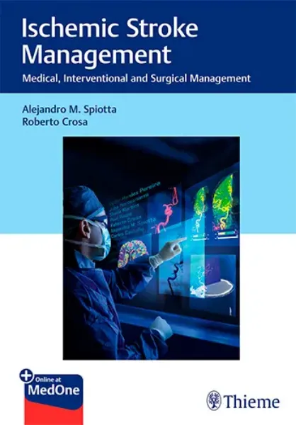 Imagem de Ischemic Stroke Management: Medical, Interventional and Surgical Management