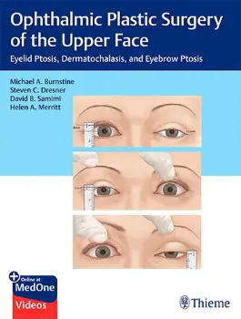Imagem de Ophthalmic Plastic Surgery of the Upper Face: Yelid Ptosis, Dermatochalasis, and Eyebrow Ptosis