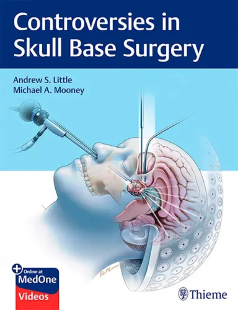 Imagem de Controversies in Skull Base Surgery